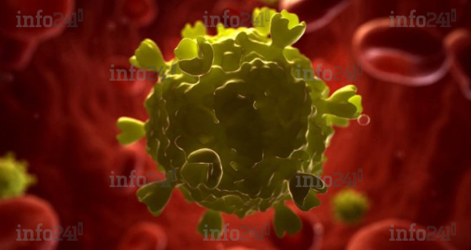 Le Sida trouverait ses origines à Kinshasa (RDC) au cours des années 20